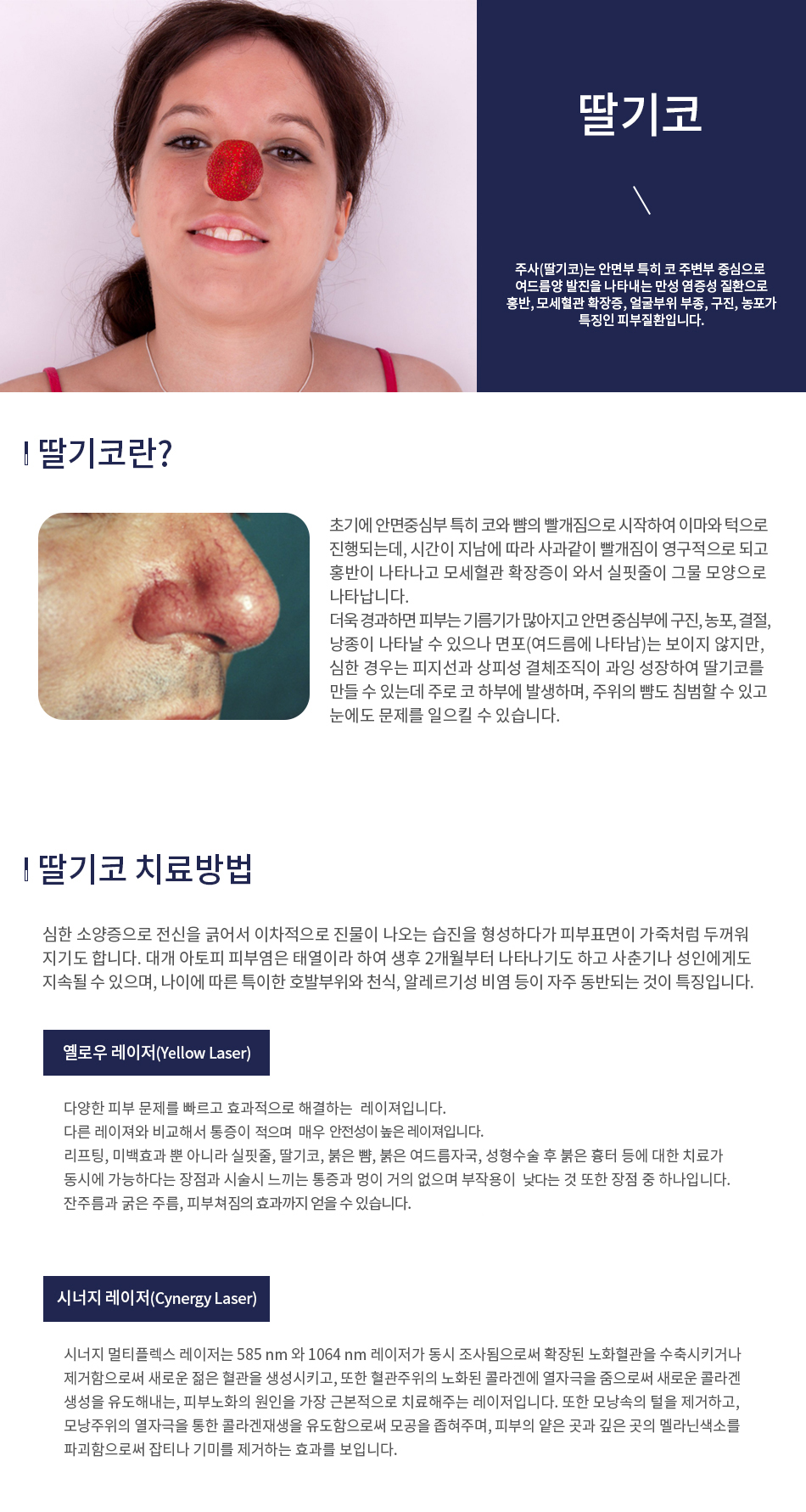 딸기코